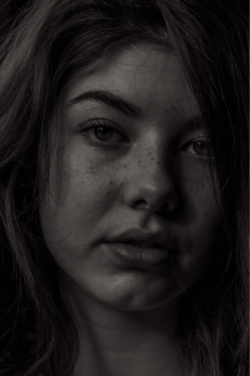 best acids for treating acne best acids for treating acne